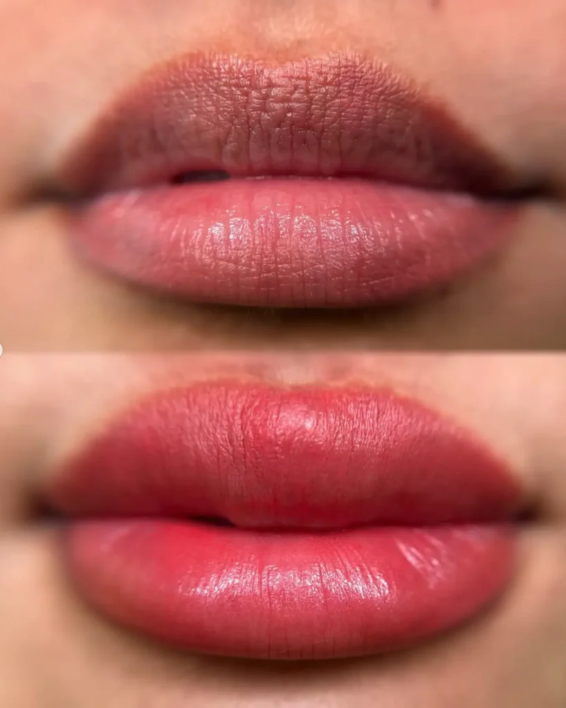 cosmetic lip tattooing