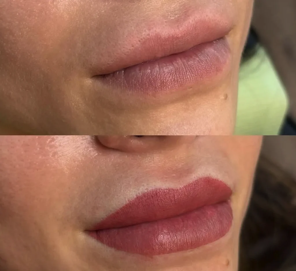 cosmetic tattooing