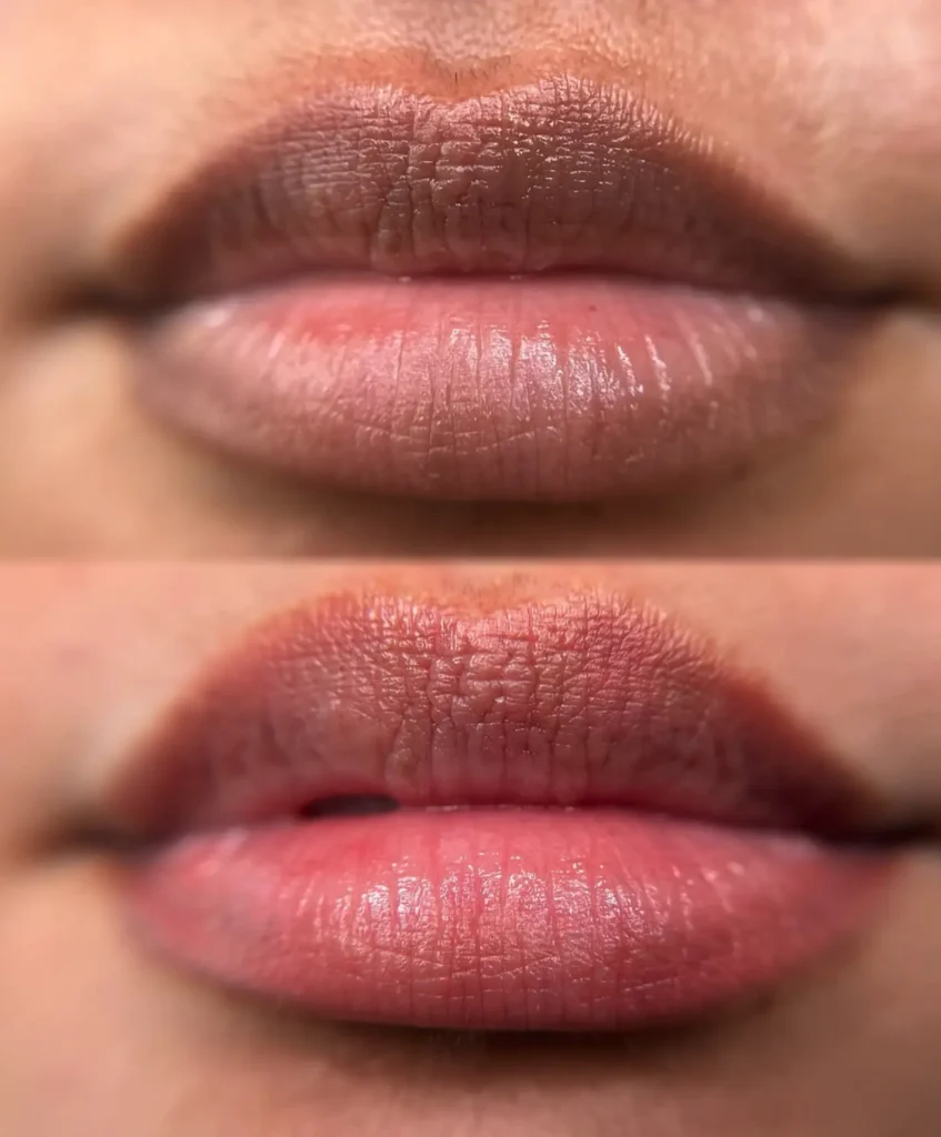 cosmetic tattooing Melbourne