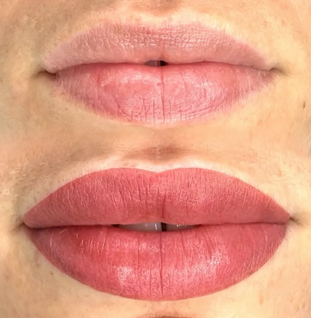 cosmetic lip tattoo in Melbourne